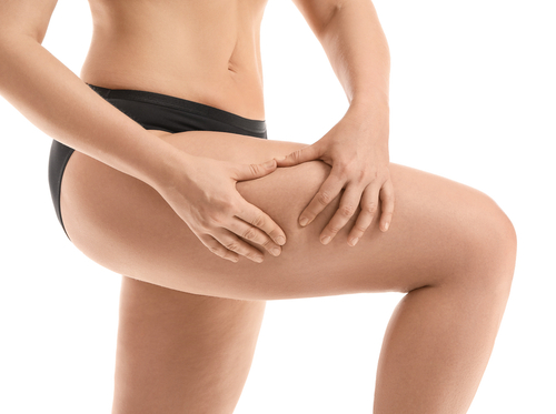 Dimentica le Gambe Pesanti: Rimedi Naturali e Integratori per un Benessere Ottimale!