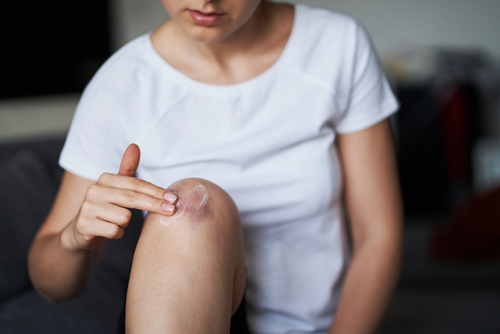 Creme all’Arnica: Efficacia Contro Ematomi e Dolori da Trauma, Come Scegliere la Migliore